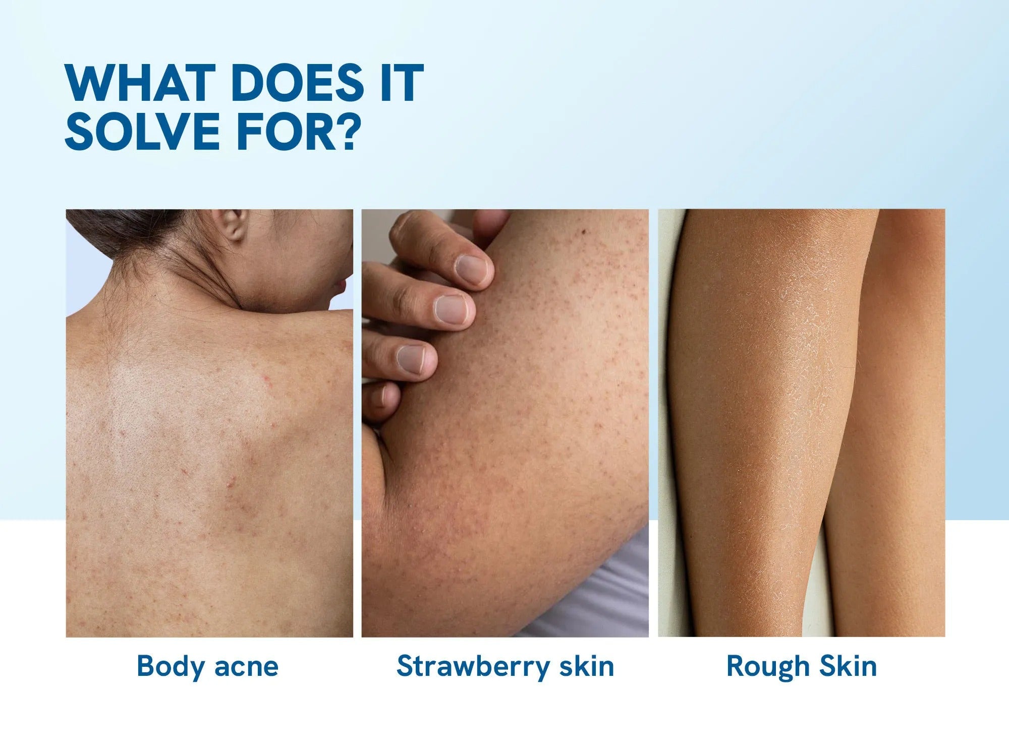 1% Salicylic Acid Body Wash - 250 mL